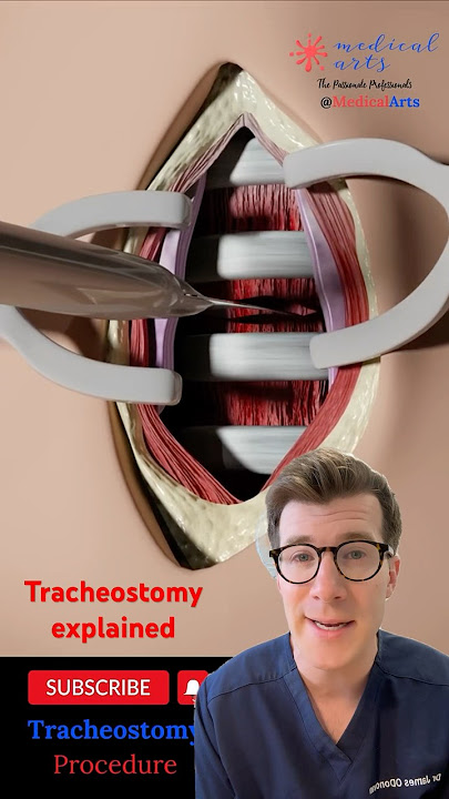 Doctor explains tracheostomy #shorts