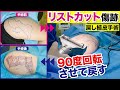 【きずクリ手術動画】上腕リストカット跡 戻し植皮手術#001 #形成外科 #きずときずあとのクリニック #村松英之