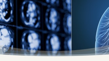 Semiconductor Detector