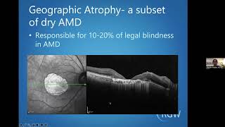 AgeRelated Macular Degeneration (AMD) 101