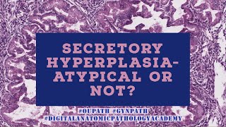 Secretory Hyperplasia Atypical or Not?