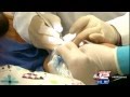 Receding Gums Cure Without Gum Grafting: Pinhole Surgical Technique