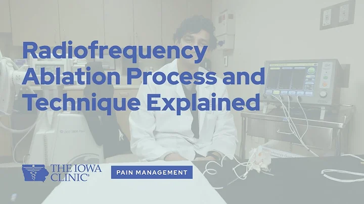 Radiofrequency Ablation Technique and Process Explained