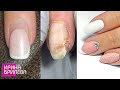 Tрэш!!! 💅 ХИТРОСТЬ и онихолизис 💅 РЕМОНТ ногтя и свадебный МАНИКЮР