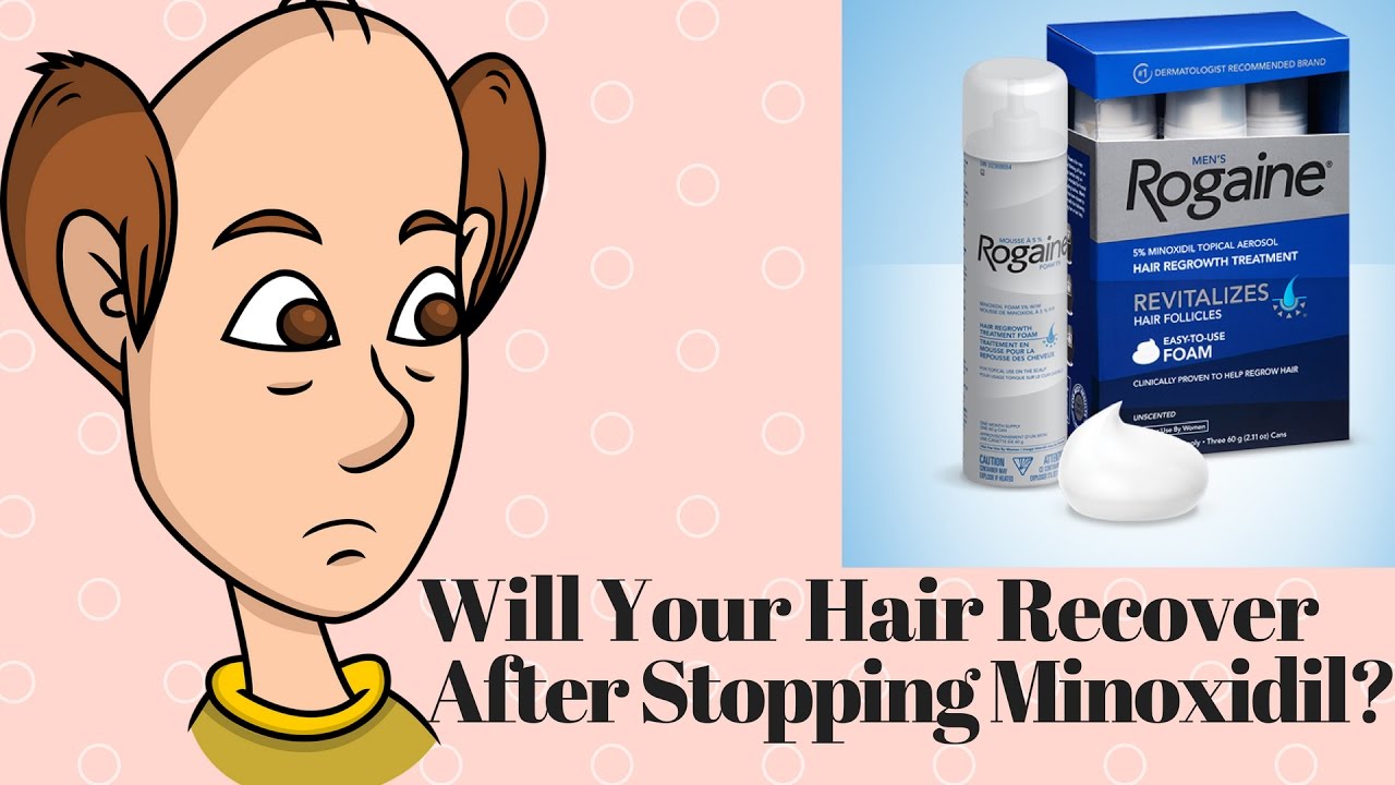 Will Your Hair After Stopping Minoxidil - YouTube