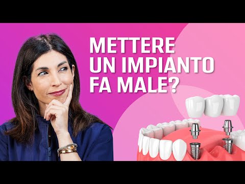 Mettere un impianto