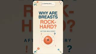 Breast Engorgement After Delivery: Don’t Ignore These Signs ⚠️ #shorts #breastfeedingtips
