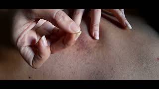 Back scratching video to sleep | Tingling video 😴😴