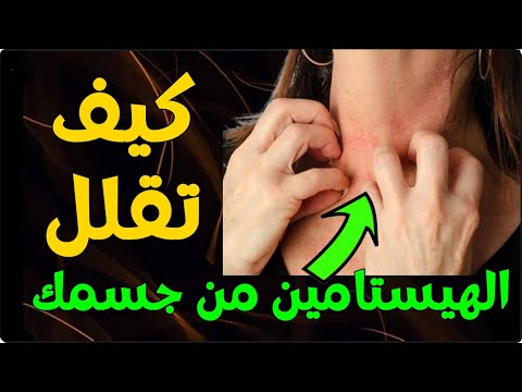 كيف تقلل الهيستامين من جسمك
