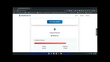 MediPredict AI – Breast Cancer Detection Web App Using Machine Learning _ Flask, Python & ML Model