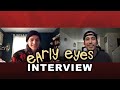 Early Eyes Interview | Signing To Epitaph Records & ‘Sunbathing’ EP