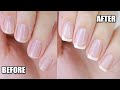 How To ACTUALLY Grow Your Nails