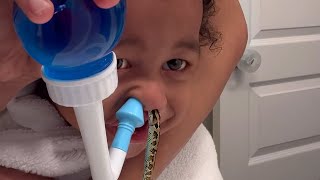 a snake got stuck in his nose..