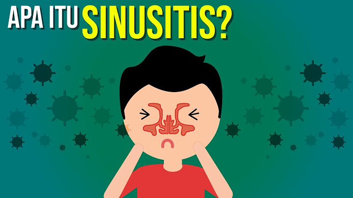 Apa itu Sinusitis?