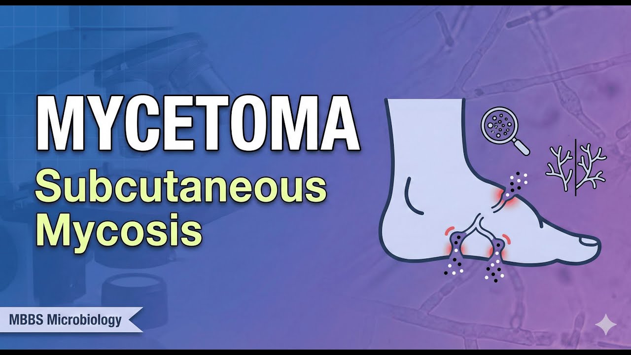 Subcutaneous Mycosis | Mycetoma  | Causative Agents, Clinical Features, Diagnosis & Treatment