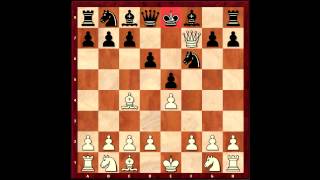 Celebrity Beginners Guide- Fools Mate Scholar's Mate and a nice tactic Wealth