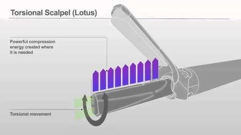 Lotus - Torsional Vibration