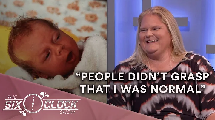 The World's First IVF Baby: Louise Brown Tells Her Story | The Six O'Clock Show - DayDayNews