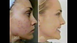 90s Are All That Commercials(December 23, 2014 #1)