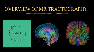 MR TRACTOGRAPHY/ DIFFUSION TENSOR IMAGING (DTI) / WHITE MATTER TRACTS ON MRI.