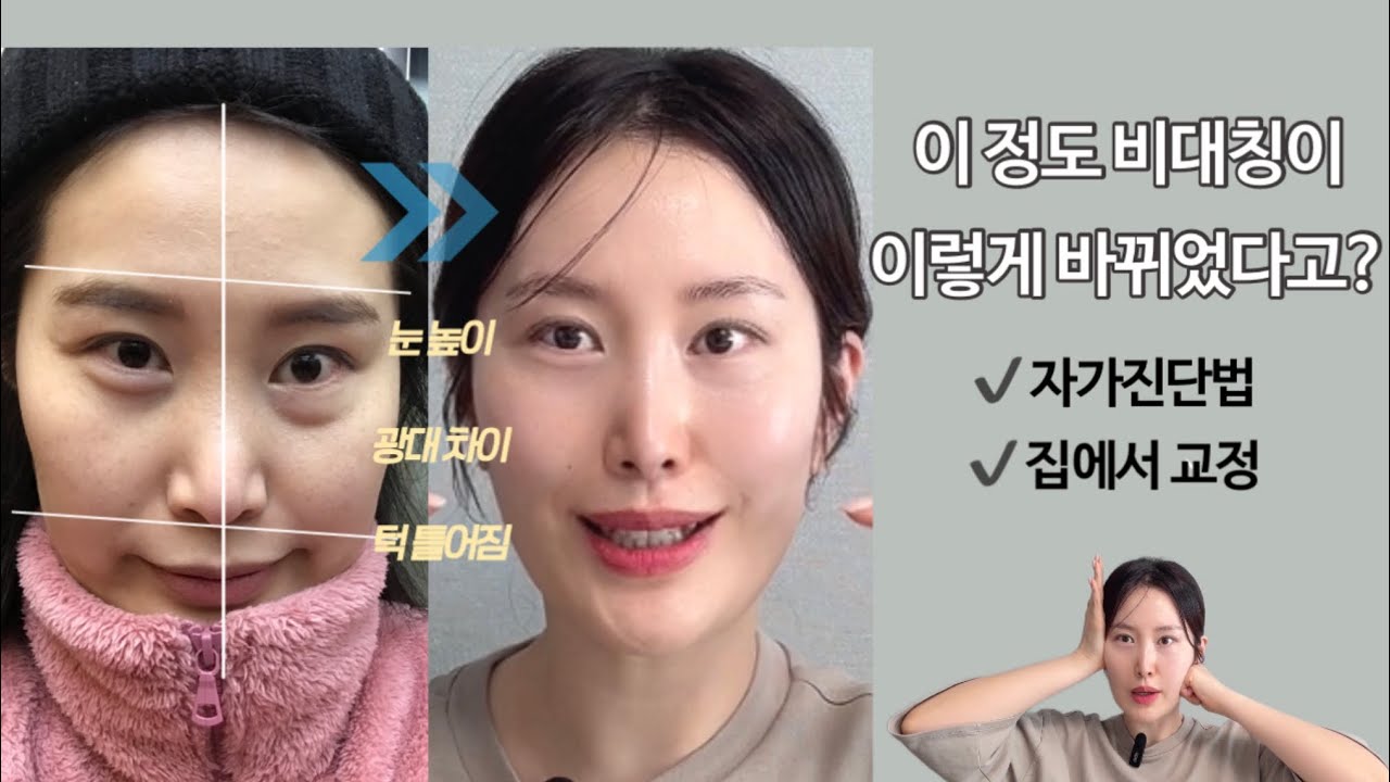 👉 이 정도 비대칭이 이렇게 바뀌었습니다!! 직접 효과 본 얼굴 교정 마사지