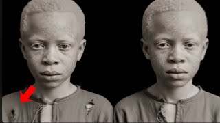 Les jumeaux noirs albinos choisis pour une expérience scientifique que personne ne pouvait expliquer