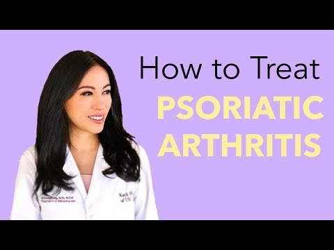 How do you treat Psoriatic Arthritis? An Overview.