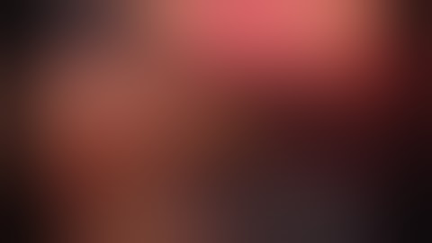 SA-52 laparoscopic partial nephrectomy - hilus tumor - floseal - Serdar Aykan MD Assoc Prof