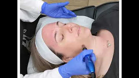 Rejuvapen Microneedling Treatment - Glow Aesthetic Center