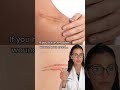 How To Treat Scars According To A Dermatologist Shorts mp3
