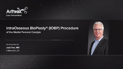 IntraOsseous BioPlasty® (IOBP) Procedure of the Medial Femoral Condyle
