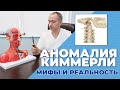 Аномалия Киммерли. Что это? Как лечить?