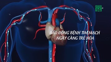 Báo động bệnh Tim Mạch ngày càng trẻ hóa| VTC14