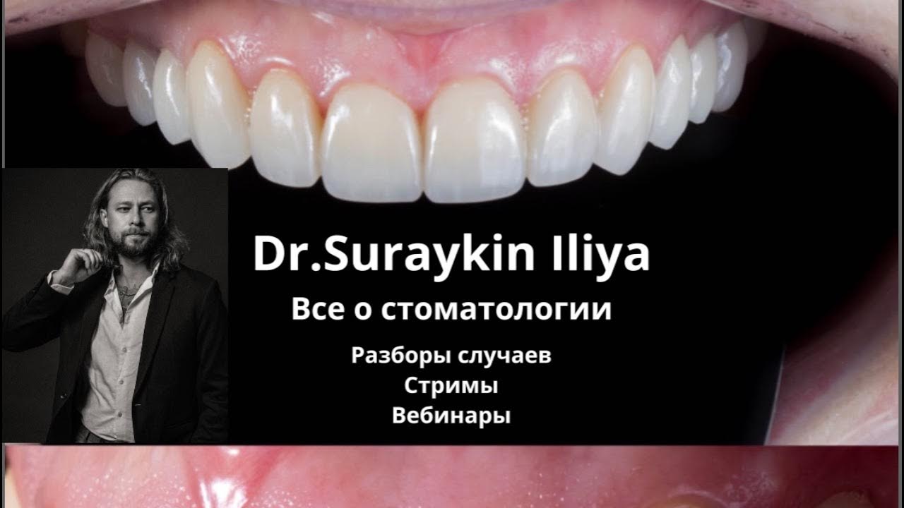 Протезирование зубов коронками Разбор клинического случая#стоматология ...