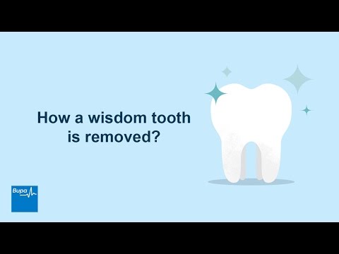How a wisdom tooth is removed