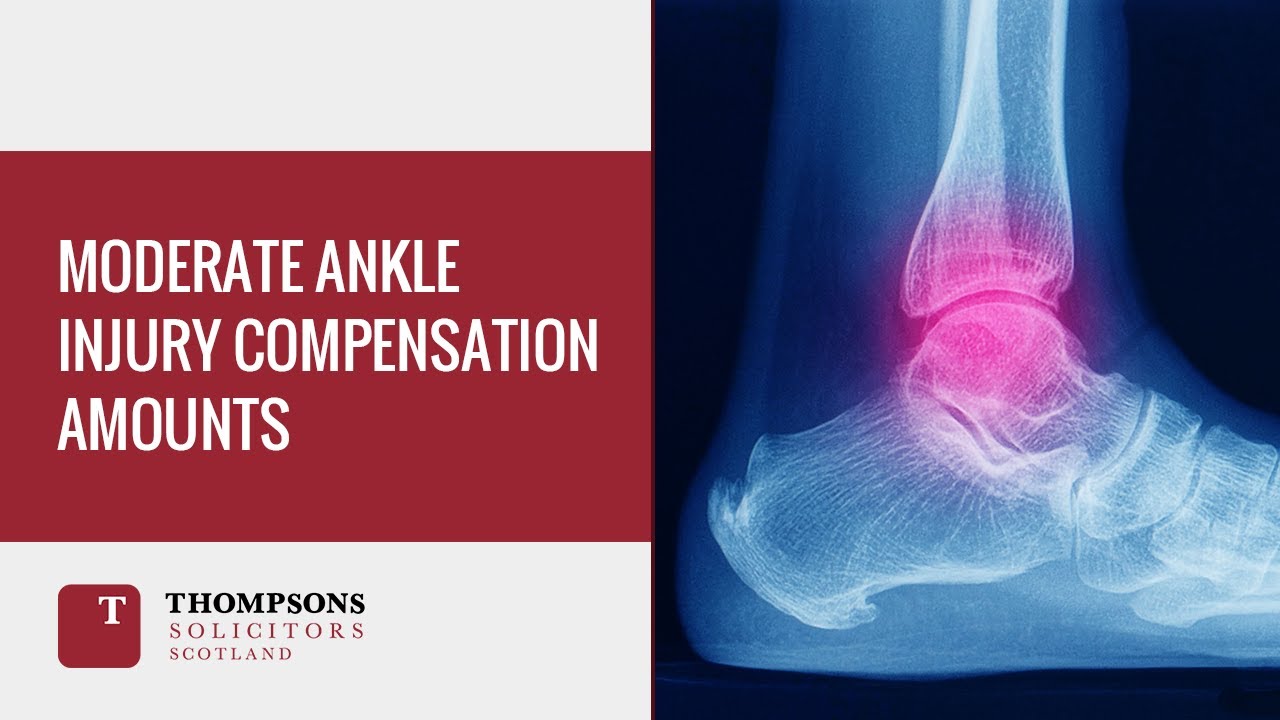 Moderate Ankle Compensation