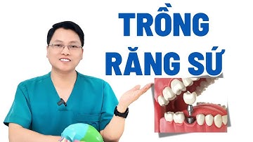 Trồng Răng Sứ Trên Răng Implant |Dr Cường Official
