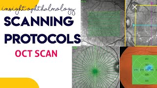 OCT SCANNING PROTOCOLS made easy || line scan, macular cube, raster scan