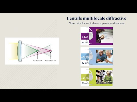 Vidéo: Les contacts multifocaux fonctionnent-ils pour l'astigmatisme ?