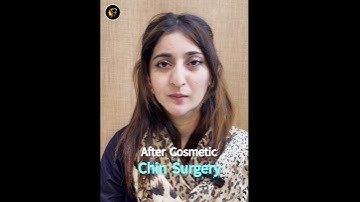Genioplasty | Asymmetric Face Treatment  | Dr Tauseef Ahmad