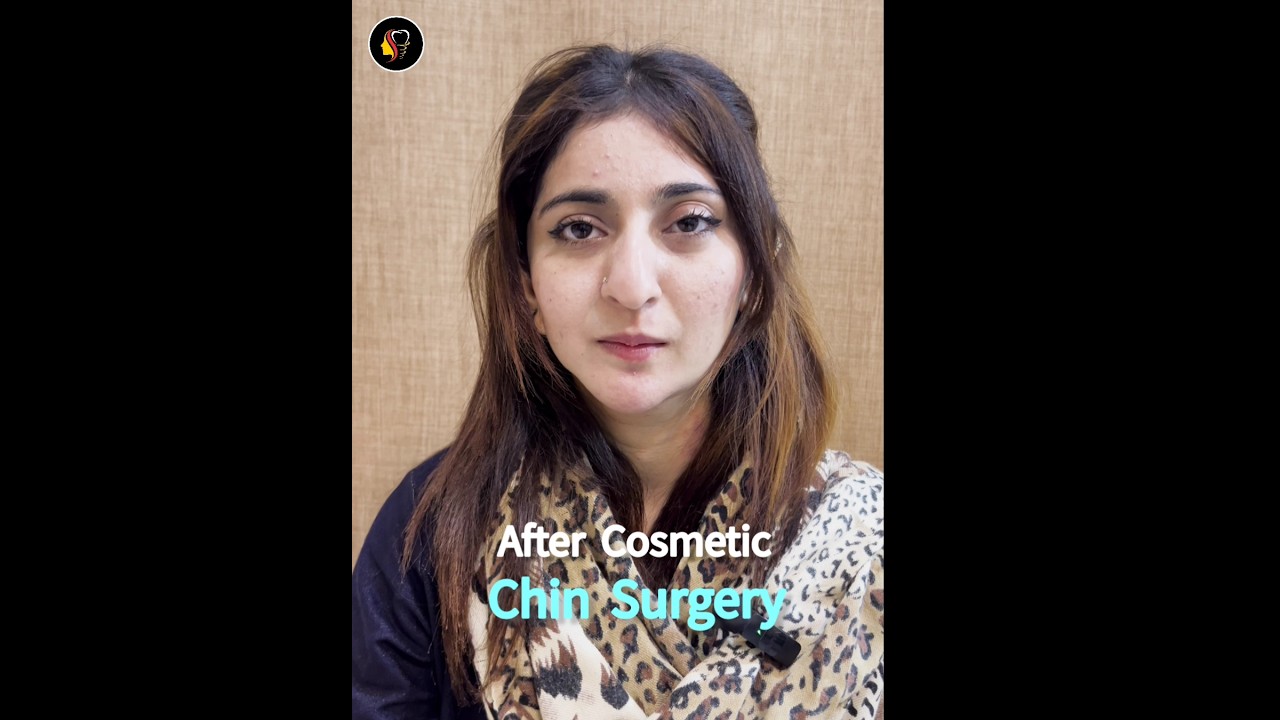 Genioplasty | Asymmetric Face Treatment  | Dr Tauseef Ahmad