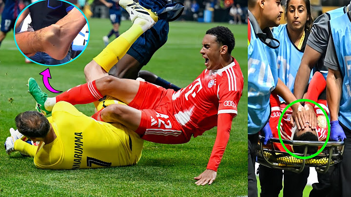 JAMAL Musiala SCHWERERBEINBRUCH nach ZUSAMMENPRALL MIT Donnarumma | MUSIALA Verletzung gegen PSG
