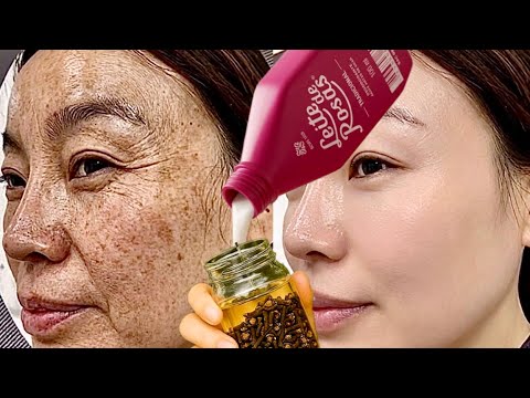 SAI TUDO! RUGA TORTA E MANCHAS PRETAS, MINHA DERMATOLOGISTA ENSINOU…