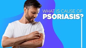 What is the main cause of psoriasis?