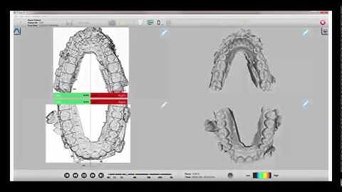T-Scan Software Version 9.0