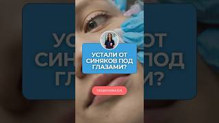 Темные круги под глазами? Патчи не помогут! | Мезотерапия и биоревитализация
