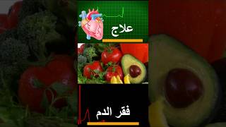 علاج فقر الدم