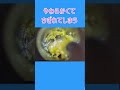 やわらかい耳垢を吸い出す #earcleaning