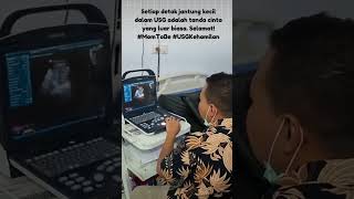 Setiap detak jantung kecil dalam USG adalah tanda cinta yang luar biasa. Selamat! #MomToBe #USG