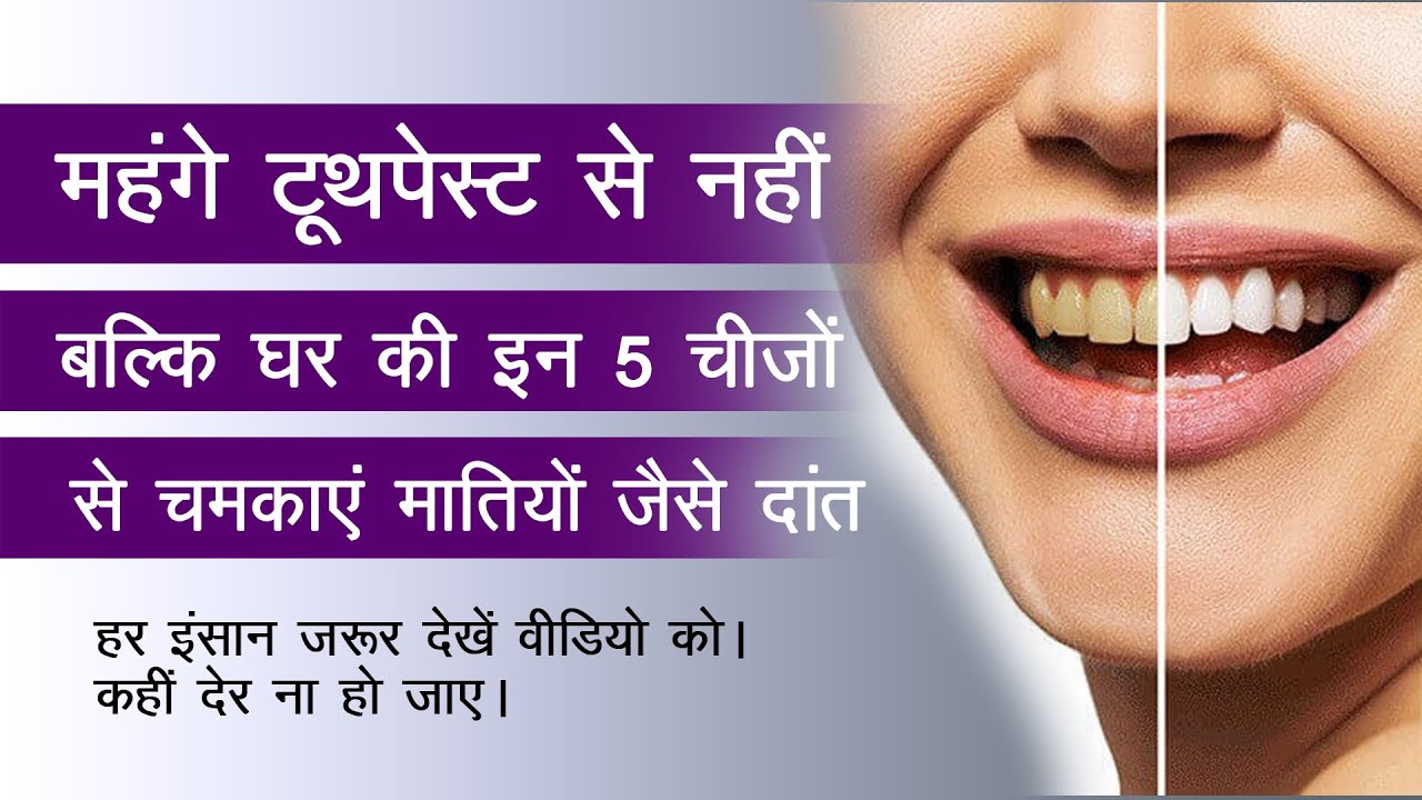 home remedies can help you to whiten your teeth naturally in Hindi